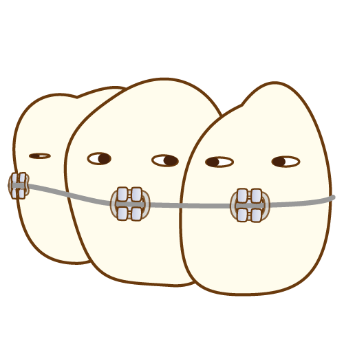 ワイヤー調整中の様子
