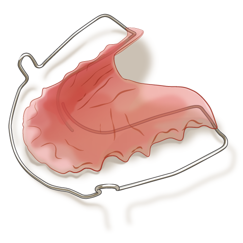 保定期間のチェック